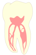 歯の中身の歯髄と血管